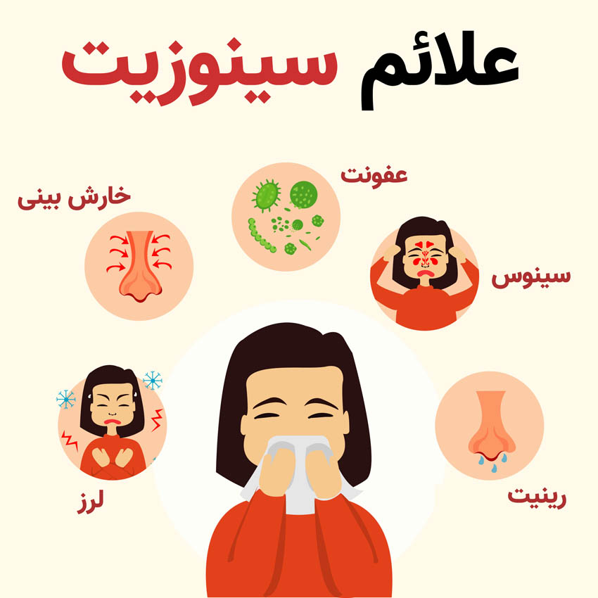 سینوزیت چیست؟