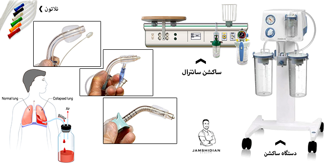 دستگاه ساکشن
