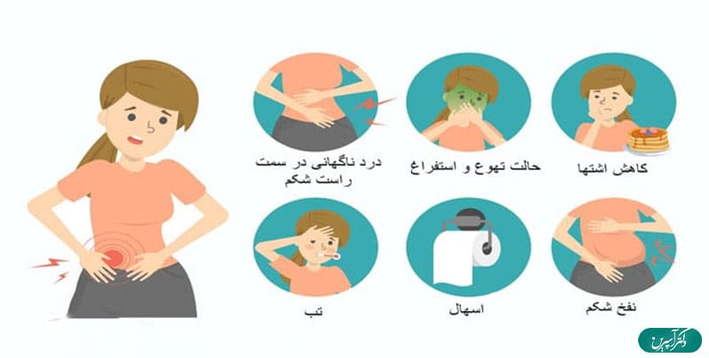 آپاندیس