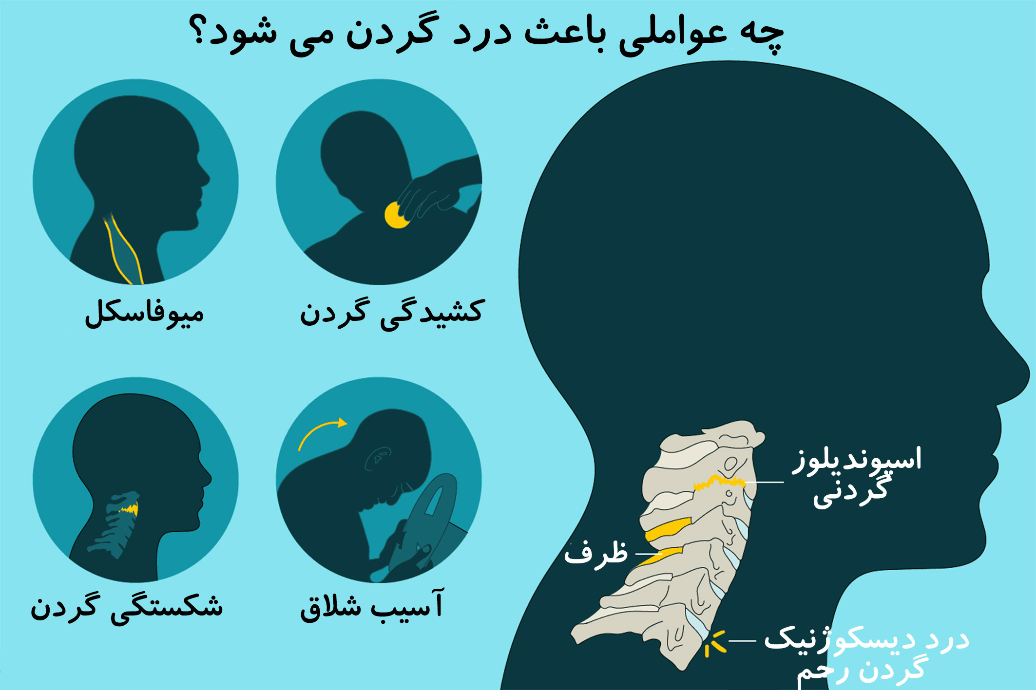 درمان گردن درد