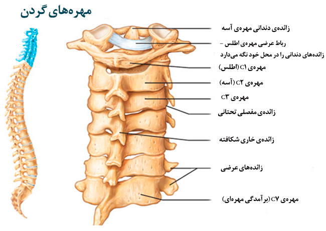 درمان گردن درد