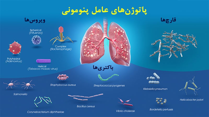 بیماری پنومونی