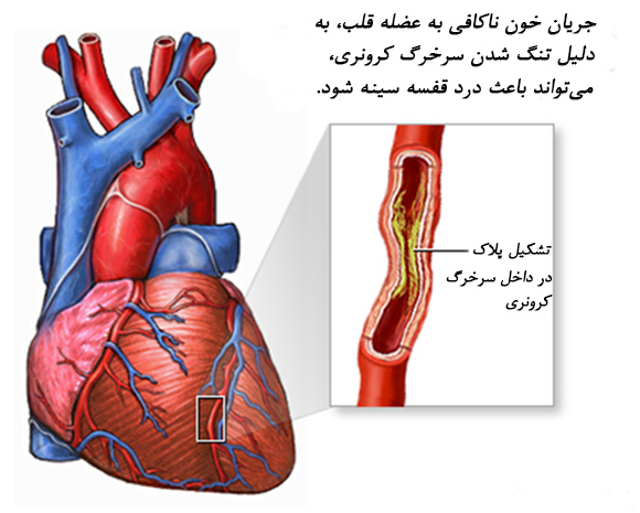 آنژین