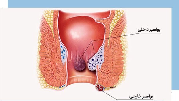 همورویید