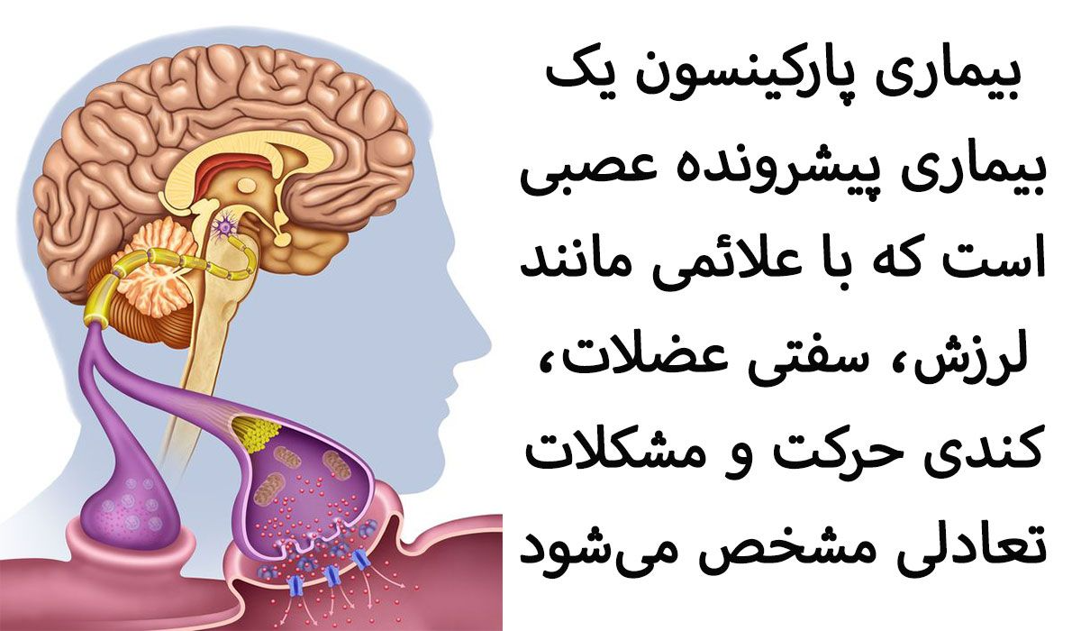 بیماری پارکینسون