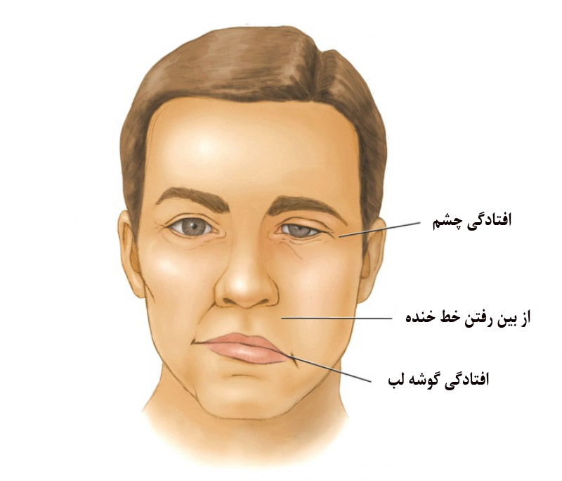 فلج بلز