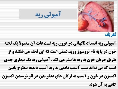 آمبولی ریه