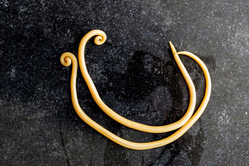 آسکاریازیس