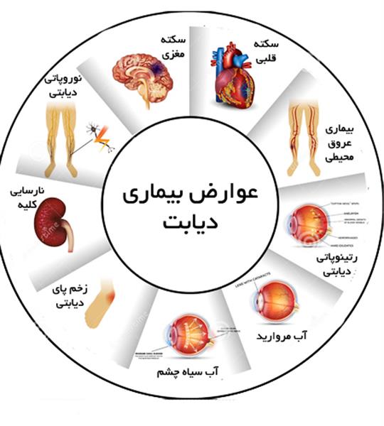 بیماری دیابت