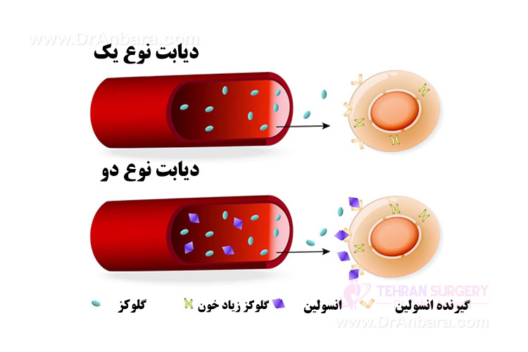 بیماری دیابت