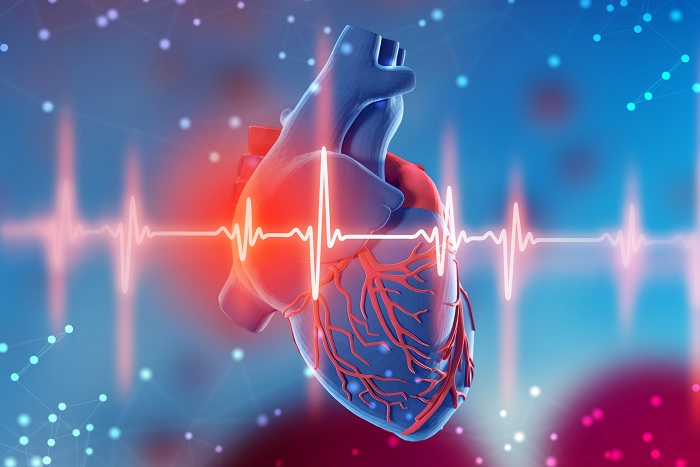 سکته قلبی چیست؟ عوامل سکته قلبی در چیست؟