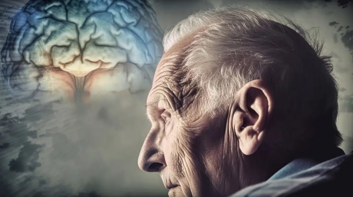 بیماری آلزایمر چیست؟