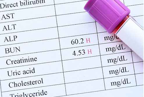 اوره خون