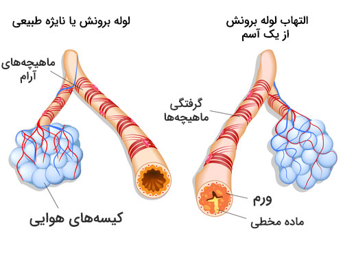 ریه