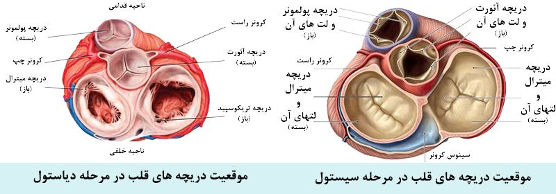 دریچه میترال