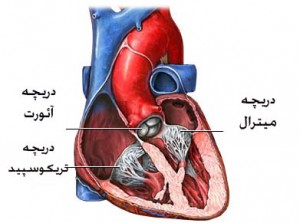 دریچه میترال